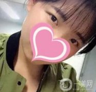 濟南中心醫(yī)院價格表，雙眼皮整形日記公布