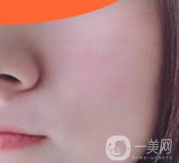 沈陽伊美爾整形醫(yī)院價格表，附祛斑*果展示