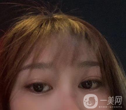 青島新陽光婦產(chǎn)醫(yī)院縮陰手術(shù)恢復(fù)經(jīng)歷和價格價目表一覽