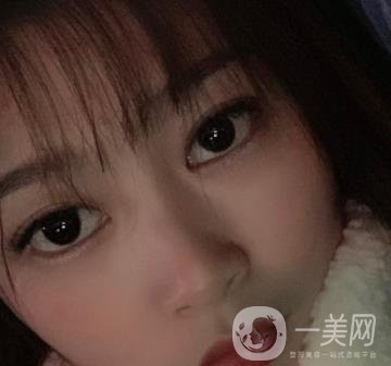 青島新陽光婦產(chǎn)醫(yī)院縮陰手術(shù)恢復(fù)經(jīng)歷和價格價目表一覽