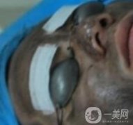 上海星和醫(yī)美整形醫(yī)院*祛斑果圖和價格價目表2020年