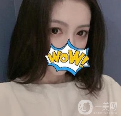 武漢艾萊美醫(yī)療整形醫(yī)院價(jià)格表項(xiàng)目收費(fèi)明細(xì)，附雙眼皮案例