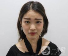 西安華旗唯美整形醫(yī)院做*多少錢？價格表收費明細和案例分享