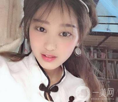 西安華旗唯美整形醫(yī)院做*多少錢(qián)？?jī)r(jià)格表收費(fèi)明細(xì)和案例分享