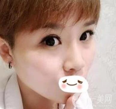 四川省人民醫(yī)院整形科駝峰鼻矯正多少錢(qián)？?jī)r(jià)格表2020更新