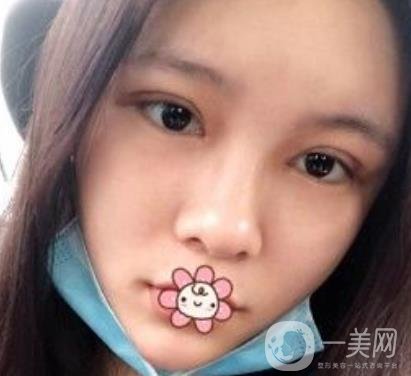 襄陽中心醫(yī)院整形美容科價(jià)格表2020版出爐，附雙眼皮日記