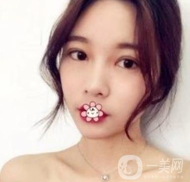 襄陽中心醫(yī)院整形美容科價(jià)格表2020版出爐，附雙眼皮日記