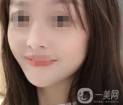 岳陽(yáng)市一人民醫(yī)院整形美容科價(jià)格表及祛斑案例發(fā)布