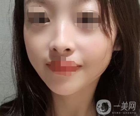 岳陽(yáng)市一人民醫(yī)院整形美容科價(jià)格表及祛斑案例發(fā)布