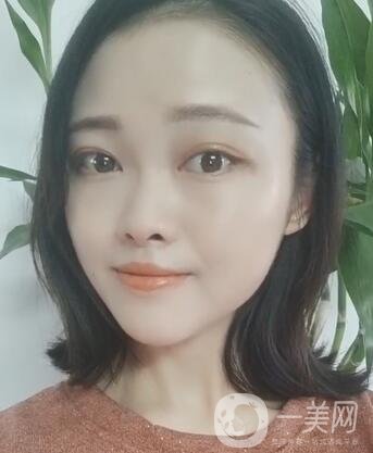 徐州亞韓整形醫(yī)院價(jià)格表費(fèi)用明細(xì)，附面部除皺日記展示