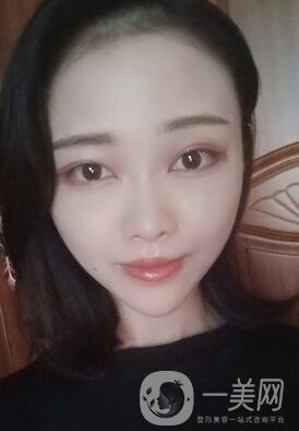 徐州亞韓整形醫(yī)院價(jià)格表費(fèi)用明細(xì)，附面部除皺日記展示