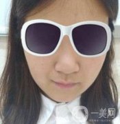 北京亞楠容悅醫(yī)療美容鼻部手術(shù)果靠譜嗎?2020年價格明細一覽表