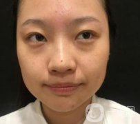 北京知音醫(yī)療美容熱瑪吉果怎么樣？貴嗎？收費價格表2020公布