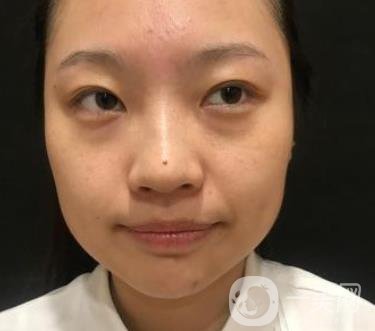 北京知音醫(yī)療美容熱瑪吉*果怎么樣？貴嗎？收費價格表2020公布