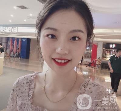 北京知音醫(yī)療美容熱瑪吉*果怎么樣？貴嗎？收費價格表2020公布