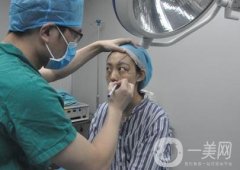 成都美容整形醫(yī)院做脂肪填充全臉果靠譜嗎?近期價格表和案例參考