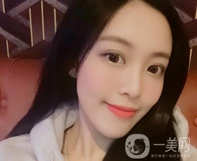 成都美容整形醫(yī)院做脂肪填充全臉*果靠譜嗎?近期價(jià)格表和案例參考