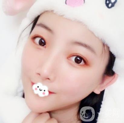 無錫二院雙眼皮做得好的醫(yī)生?附2020整形價(jià)格表及案例