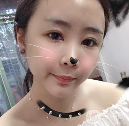 重醫(yī)附一院祛痣多少錢一顆?2020整形價(jià)格表及案例*果圖分享