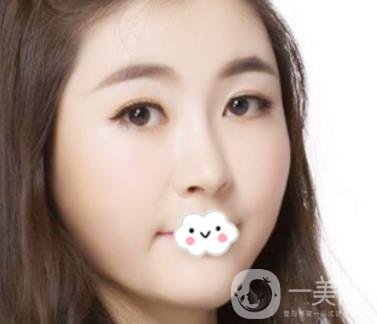 南昌二附院整形科新版價(jià)格表發(fā)布,附隆鼻案例前后