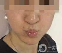 寧波第一醫(yī)院整形美容科價(jià)格表（價(jià)格）新版發(fā)布,及*案例果