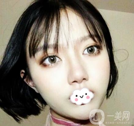 贛南醫(yī)學(xué)院第一附屬醫(yī)院整形美容科價格表2020+雙眼皮案例一覽