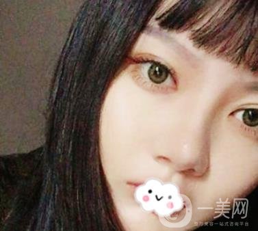 贛南醫(yī)學(xué)院第一附屬醫(yī)院整形美容科價格表2020+雙眼皮案例一覽