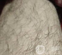 合肥華美整形醫(yī)院價(jià)格表，附脫毛案例