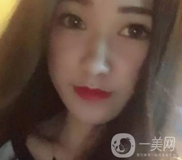徐州第一人民醫(yī)院整形科價(jià)格表，含激光祛疤*果