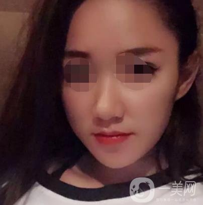 徐州第一人民醫(yī)院整形科價(jià)格表，含激光祛疤*果