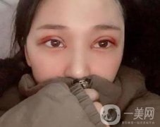 恩施州中心醫(yī)院美容整形科怎么樣？?jī)r(jià)格表和雙眼皮整形經(jīng)歷分享