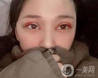 恩施州中心醫(yī)院美容整形科怎么樣？?jī)r(jià)格表和雙眼皮整形經(jīng)歷分享