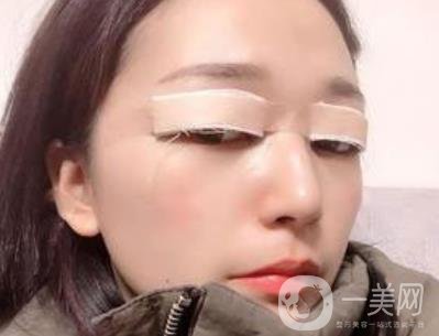 恩施州中心醫(yī)院美容整形科怎么樣？?jī)r(jià)格表和雙眼皮整形經(jīng)歷分享