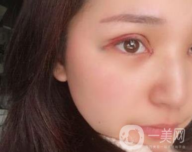 恩施州中心醫(yī)院美容整形科怎么樣？?jī)r(jià)格表和雙眼皮整形經(jīng)歷分享