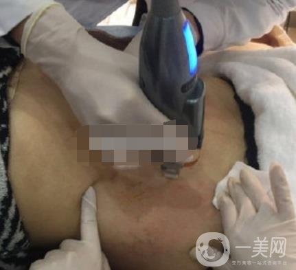 汾陽醫(yī)院美容整形科祛妊娠紋怎么樣？手術(shù)項目收費(fèi)價格表和案例一覽