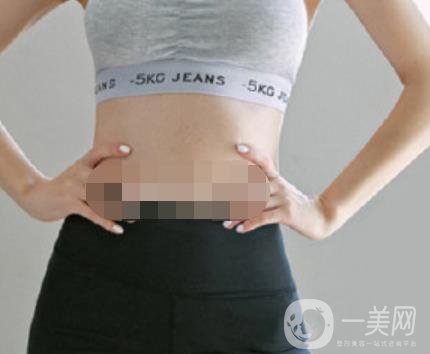 汾陽醫(yī)院美容整形科祛妊娠紋怎么樣？手術(shù)項目收費(fèi)價格表和案例一覽