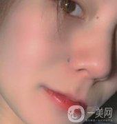 黃岡市中心醫(yī)院美容整形科祛痣多少錢(qián)？?jī)r(jià)格費(fèi)用表和果圖精選