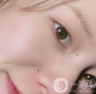 黃岡市中心醫(yī)院美容整形科祛痣多少錢？?jī)r(jià)格費(fèi)用表和*果圖精選