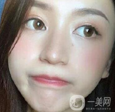 荊州市第三人民醫(yī)院整形美容科*祛斑*果好嗎？收費(fèi)價格明細(xì)表一覽