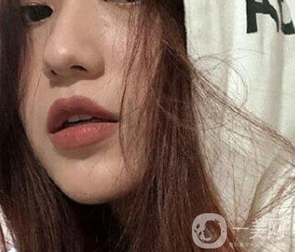 荊州市第三人民醫(yī)院整形美容科*祛斑*果好嗎？收費(fèi)價格明細(xì)表一覽