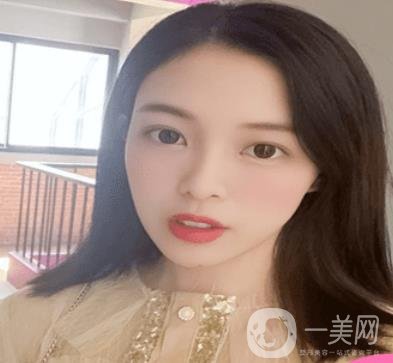 贛州附屬醫(yī)院整形美容科價格表及點痣案例公布，速覽