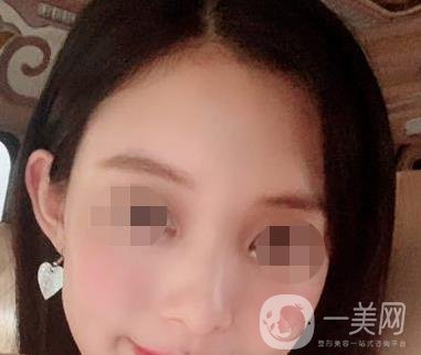 贛州附屬醫(yī)院整形美容科價格表及點痣案例公布，速覽