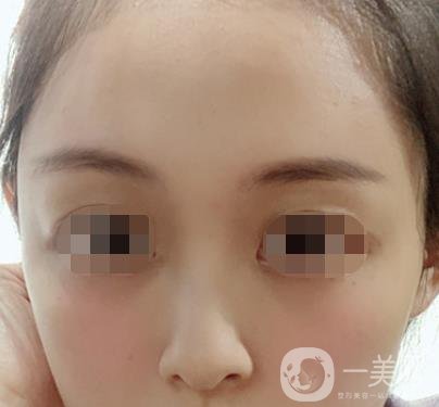 贛州附屬醫(yī)院整形美容科價格表及點痣案例公布，速覽