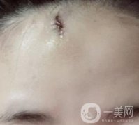 南昌二附院整形美容科價(jià)格表及祛痣日志公開(kāi)，速覽