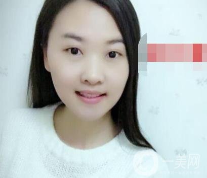北京市海淀醫(yī)院口腔科價格表2020更新，附牙齒矯正案例