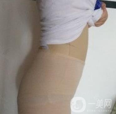 襄陽市第一人民醫(yī)院整形美容科吸脂瘦肚子多少錢？價(jià)格表整形日記一覽