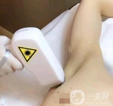 山東省立醫(yī)院整形科激光脫毛*果好嗎?價(jià)格收費(fèi)標(biāo)準(zhǔn)表一覽