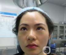 廣州南方醫(yī)院去眼袋費(fèi)用多少？2020整形價(jià)格表一覽