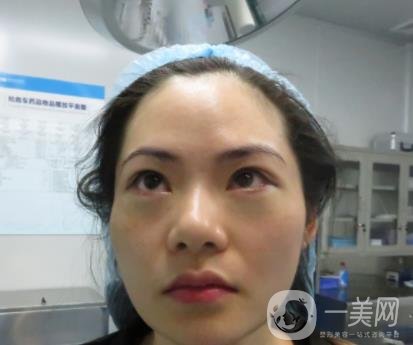 廣州南方醫(yī)院去眼袋費(fèi)用多少?2020整形價(jià)格表一覽