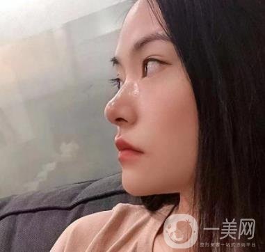 廣州南方醫(yī)院去眼袋費(fèi)用多少?2020整形價(jià)格表一覽
